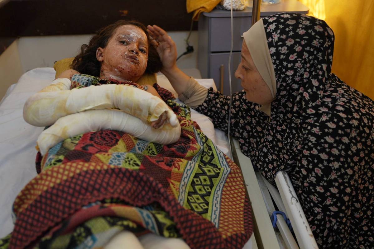 70% das vítimas de queimaduras em Gaza são crianças – monitor do Oriente Médio